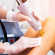 Laser Hair Removal