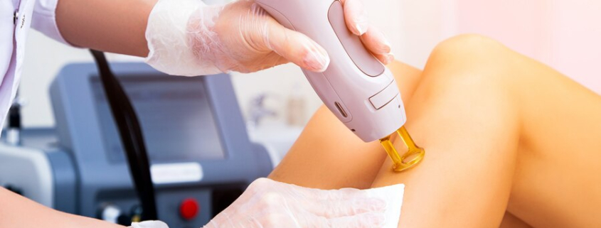 Laser Hair Removal